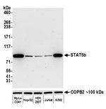 STAT5b Antibody in Western Blot (WB)