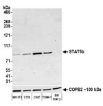 STAT5b Antibody in Western Blot (WB)