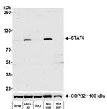 STAT6 Antibody in Western Blot (WB)