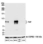 Fibroblast Activation Protein alpha/FAP Antibody in Western Blot (WB)