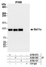 Bcl11a Antibody in Immunoprecipitation (IP)