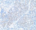 BRD9 Antibody in Immunohistochemistry (Paraffin) (IHC (P))