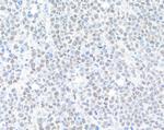 BRD9 Antibody in Immunohistochemistry (Paraffin) (IHC (P))