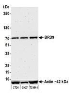 BRD9 Antibody in Western Blot (WB)
