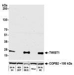 TWIST1 Antibody in Western Blot (WB)