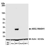 ASCL1/MASH1 Antibody in Western Blot (WB)