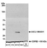 ASCL1/MASH1 Antibody in Western Blot (WB)