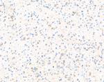 Doublecortin Antibody in Immunohistochemistry (Paraffin) (IHC (P))