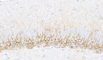 Doublecortin Antibody in Immunohistochemistry (Paraffin) (IHC (P))