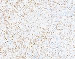 PU.1 Antibody in Immunohistochemistry (IHC)