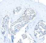 PU.1 Antibody in Immunohistochemistry (IHC)