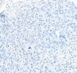 PU.1 Antibody in Immunohistochemistry (IHC)