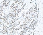 PARP1 Antibody in Immunohistochemistry (IHC)