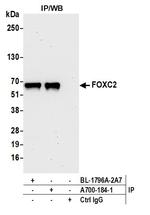 FOXC2 Antibody in Immunoprecipitation (IP)
