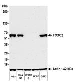 FOXC2 Antibody in Western Blot (WB)