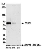 FOXC2 Antibody in Western Blot (WB)