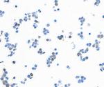 NF-H Antibody in Immunocytochemistry (ICC/IF)