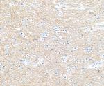 NF-H Antibody in Immunohistochemistry (IHC)