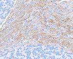 NF-H Antibody in Immunohistochemistry (IHC)