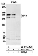 NF-H Antibody in Immunoprecipitation (IP)