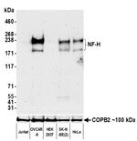 NF-H Antibody in Western Blot (WB)