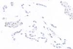 ThPOK Antibody in Immunocytochemistry (ICC/IF)