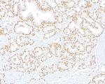 ThPOK Antibody in Immunohistochemistry (Paraffin) (IHC (P))