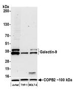 Galectin-9/Gal-9 Antibody in Western Blot (WB)