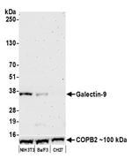 Galectin-9/Gal-9 Antibody in Western Blot (WB)