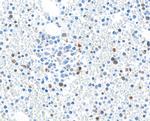 TGF-beta 1 Antibody in Immunohistochemistry (Paraffin) (IHC (P))