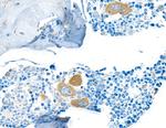 TGF-beta 1 Antibody in Immunohistochemistry (Paraffin) (IHC (P))