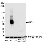 CD28 Antibody in Western Blot (WB)