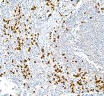 S100A9 Antibody in Immunohistochemistry (Paraffin) (IHC (P))