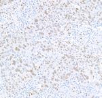 FOX2/RBM9 Antibody in Immunohistochemistry (Paraffin) (IHC (P))