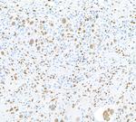 FOX2/RBM9 Antibody in Immunohistochemistry (Paraffin) (IHC (P))