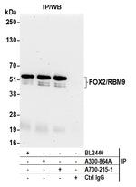 FOX2/RBM9 Antibody in Immunoprecipitation (IP)