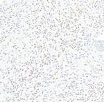 ZEB1 Antibody in Immunohistochemistry (Paraffin) (IHC (P))