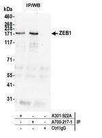 ZEB1 Antibody in Immunoprecipitation (IP)