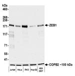 ZEB1 Antibody in Western Blot (WB)