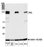 AXL Antibody in Western Blot (WB)