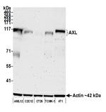 AXL Antibody in Western Blot (WB)