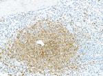 CD79B Antibody in Immunohistochemistry (Paraffin) (IHC (P))