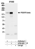 PDGFR beta Antibody in Immunoprecipitation (IP)