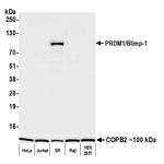 PRDM1/Blimp-1 Antibody in Western Blot (WB)