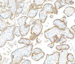 EGFR Antibody in Immunohistochemistry (Paraffin) (IHC (P))