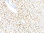 EGFR Antibody in Immunohistochemistry (Paraffin) (IHC (P))