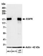 EGFR Antibody in Western Blot (WB)