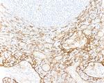 Thrombomodulin Antibody in Immunohistochemistry (Paraffin) (IHC (P))