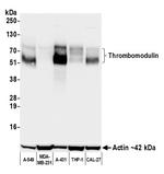 Thrombomodulin Antibody in Western Blot (WB)