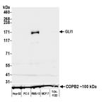 GLI1 Antibody in Western Blot (WB)